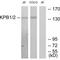 Phosphorylase Kinase Regulatory Subunit Alpha 1 antibody, A10086, Boster Biological Technology, Western Blot image 