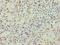 ARF6-Specific antibody, LS-C375247, Lifespan Biosciences, Immunohistochemistry frozen image 