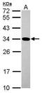Geminin DNA Replication Inhibitor antibody, GTX116125, GeneTex, Western Blot image 
