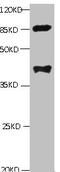 Phospholipase A2 Group VII antibody, orb243886, Biorbyt, Western Blot image 
