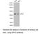 Dihydropyrimidine Dehydrogenase antibody, LS-C193016, Lifespan Biosciences, Western Blot image 