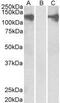 Pumilio homolog 2 antibody, GTX89543, GeneTex, Western Blot image 