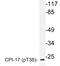 Protein Phosphatase 1 Regulatory Inhibitor Subunit 14A antibody, LS-C178046, Lifespan Biosciences, Western Blot image 