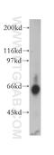 Thymine DNA Glycosylase antibody, 13370-1-AP, Proteintech Group, Western Blot image 