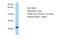 Cellular Repressor Of E1A Stimulated Genes 1 antibody, NBP1-98341, Novus Biologicals, Western Blot image 