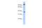 PHD Finger Protein 11 antibody, PA5-41572, Invitrogen Antibodies, Western Blot image 