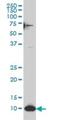 Small Nuclear RNA Activating Complex Polypeptide 5 antibody, H00010302-M07, Novus Biologicals, Western Blot image 