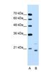 Ubiquitin Conjugating Enzyme E2 D1 antibody, NBP1-55033, Novus Biologicals, Western Blot image 