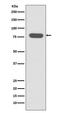 RDX antibody, M01926, Boster Biological Technology, Western Blot image 