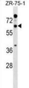 Reticulon 2 antibody, abx029573, Abbexa, Western Blot image 