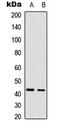 CDCA7 antibody, GTX56087, GeneTex, Western Blot image 