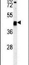 Tubulointerstitial Nephritis Antigen Like 1 antibody, PA5-23896, Invitrogen Antibodies, Western Blot image 