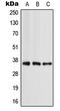 Apolipoprotein E antibody, LS-C351847, Lifespan Biosciences, Western Blot image 