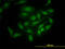 PDZ Binding Kinase antibody, LS-C133784, Lifespan Biosciences, Immunofluorescence image 