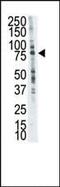 Leukocyte tyrosine kinase receptor antibody, PA5-14696, Invitrogen Antibodies, Western Blot image 