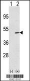 Tribbles Pseudokinase 2 antibody, MBS9214625, MyBioSource, Western Blot image 