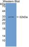 DNA Topoisomerase II Alpha antibody, MBS2028540, MyBioSource, Western Blot image 