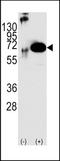 Protein Tyrosine Phosphatase Non-Receptor Type 11 antibody, TA302214, Origene, Western Blot image 