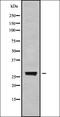 Melanoma-associated antigen 4 antibody, orb337810, Biorbyt, Western Blot image 
