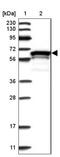 Zinc Finger Protein 655 antibody, NBP1-80625, Novus Biologicals, Western Blot image 