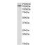 Ribonuclease 3 antibody, NB100-55410, Novus Biologicals, Western Blot image 