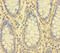Interleukin 1 Receptor Like 2 antibody, LS-C398552, Lifespan Biosciences, Immunohistochemistry paraffin image 