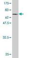 Phosphorylase Kinase Catalytic Subunit Gamma 2 antibody, H00005261-M01, Novus Biologicals, Western Blot image 