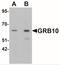 Growth Factor Receptor Bound Protein 10 antibody, NBP2-41159, Novus Biologicals, Western Blot image 