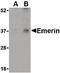 Emerin antibody, LS-B565, Lifespan Biosciences, Western Blot image 