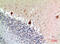 Nodal Growth Differentiation Factor antibody, A07627-1, Boster Biological Technology, Immunohistochemistry paraffin image 