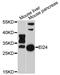 EI24 Autophagy Associated Transmembrane Protein antibody, MBS127601, MyBioSource, Western Blot image 