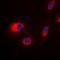 Patched 1 antibody, orb214471, Biorbyt, Immunofluorescence image 