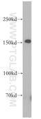 EPH Receptor A1 antibody, 18698-1-AP, Proteintech Group, Western Blot image 