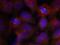 Synaptotagmin 1 antibody, PA5-37830, Invitrogen Antibodies, Immunofluorescence image 