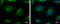 Calcium Voltage-Gated Channel Auxiliary Subunit Beta 4 antibody, GTX100202, GeneTex, Immunocytochemistry image 