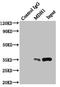 Malate Dehydrogenase 1 antibody, LS-C376102, Lifespan Biosciences, Immunoprecipitation image 