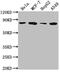 Grainyhead Like Transcription Factor 1 antibody, CSB-PA868368LA01HU, Cusabio, Western Blot image 
