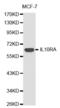 Interleukin 10 Receptor Subunit Alpha antibody, abx001512, Abbexa, Western Blot image 