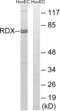 Radixin antibody, abx014777, Abbexa, Western Blot image 