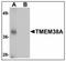 Transmembrane Protein 38A antibody, AP23924PU-N, Origene, Western Blot image 