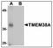 Transmembrane Protein 38A antibody, AP23924PU-N, Origene, Western Blot image 