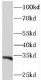 Phosphatidylinositol Transfer Protein Beta antibody, FNab06471, FineTest, Western Blot image 