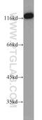 Ubiquitin Specific Peptidase 48 antibody, 12076-1-AP, Proteintech Group, Western Blot image 