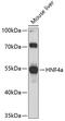 Hepatocyte Nuclear Factor 4 Alpha antibody, 14-035, ProSci, Western Blot image 
