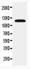 Solute Carrier Family 12 Member 1 antibody, PA5-80002, Invitrogen Antibodies, Western Blot image 