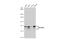 VICKZ family member 2 antibody, GTX134817, GeneTex, Western Blot image 