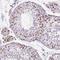 CCCTC-Binding Factor antibody, NBP2-52910, Novus Biologicals, Immunohistochemistry paraffin image 