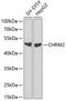 Cholinergic Receptor Muscarinic 2 antibody, GTX53938, GeneTex, Western Blot image 
