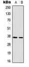 RAD51 Recombinase antibody, orb315676, Biorbyt, Western Blot image 
