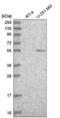 Tumor Protein P73 antibody, NBP2-58523, Novus Biologicals, Western Blot image 